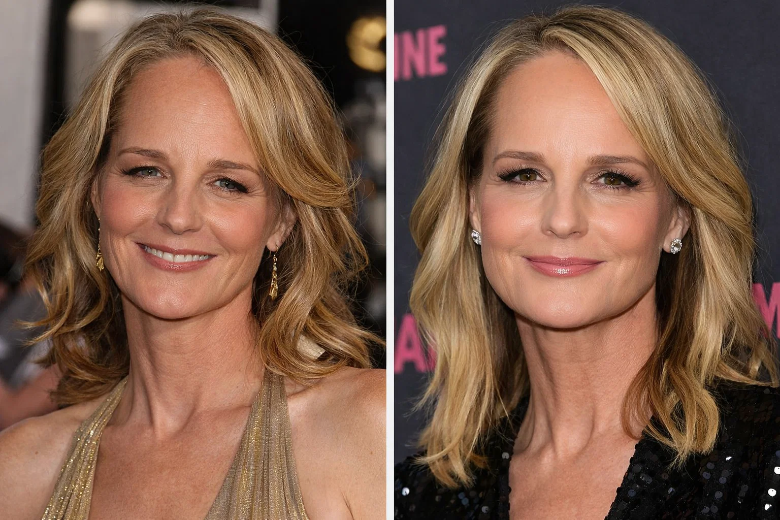 Helen Hunt Helen Hunt Plastic Surgery